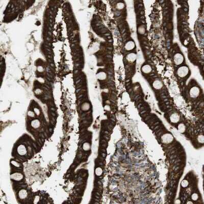 Immunohistochemistry-Paraffin: MBOAT2 Antibody [NBP1-82236]