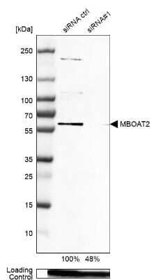 Western Blot: MBOAT2 Antibody [NBP1-82236]