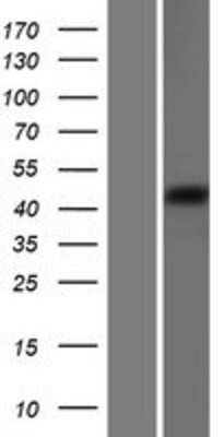 Western Blot: GOAT/MBOAT4 Overexpression Lysate [NBP2-09335]