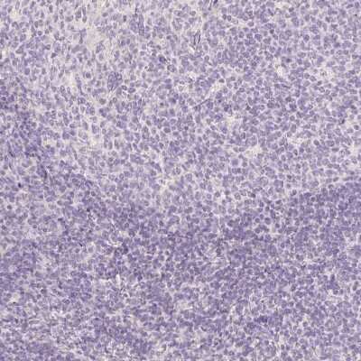 Immunohistochemistry: MBOAT7 Antibody [NBP2-49207]