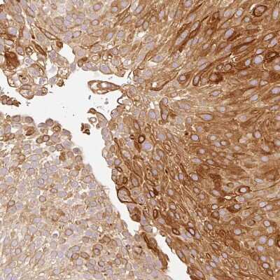 Immunohistochemistry-Paraffin: MBOAT7 Antibody [NBP2-49207]