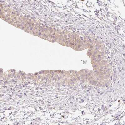 Immunohistochemistry-Paraffin: MBOAT7 Antibody [NBP2-49207]