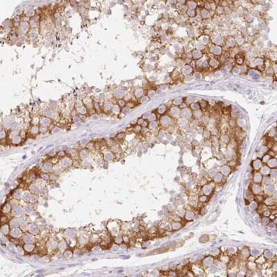Immunohistochemistry-Paraffin: MBOAT7 Antibody [NBP2-49207]