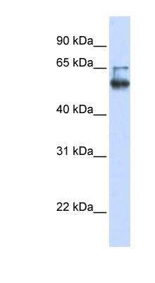 Western Blot: MBOAT7 Antibody [NBP1-62511]