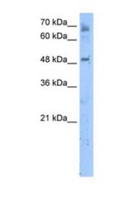 Western Blot: MBOAT7 Antibody [NBP1-69610]