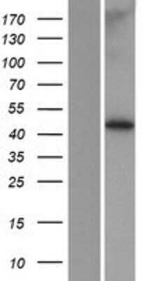 Western Blot: MBOAT7 Overexpression Lysate [NBP2-06340]