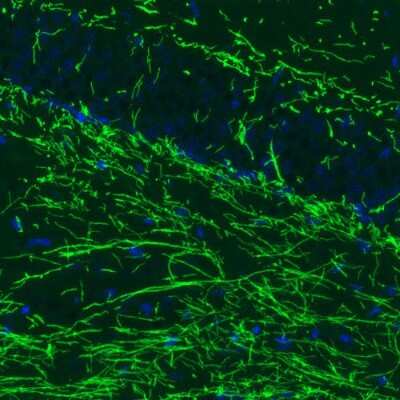 Immunohistochemistry: MBP Antibody (CL2829) [NBP2-46632]