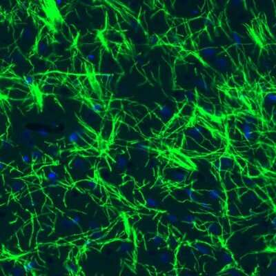 Immunohistochemistry: MBP Antibody (CL2829) [NBP2-46632]