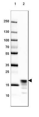 Western Blot: MBP Antibody (CL2829) [NBP2-46632]