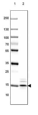 Western Blot: MBP Antibody (CL2829) [NBP2-46632]