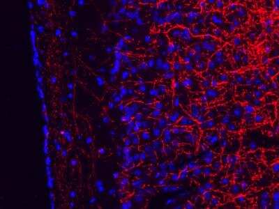 Immunohistochemistry-Frozen: MBP Antibody (2H9) - BSA Free [NBP2-22121]
