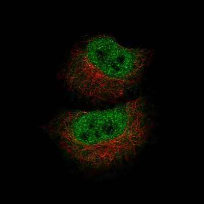 Immunocytochemistry/ Immunofluorescence: MBP Antibody (CL2819) [NBP2-46630]