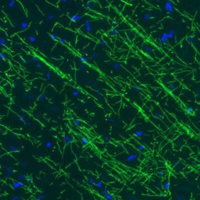 Immunohistochemistry: MBP Antibody (CL2819) [NBP2-46630]