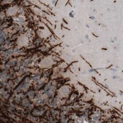 Immunohistochemistry: MBP Antibody (CL2819) [NBP2-46630]