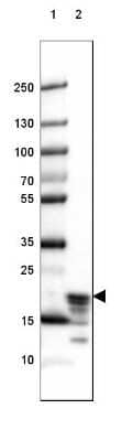 Western Blot: MBP Antibody (CL2819) [NBP2-46630]