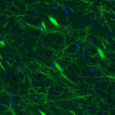 Immunohistochemistry: MBP Antibody (CL2827) [NBP2-46631]