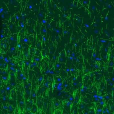 Immunohistochemistry: MBP Antibody (CL2827) [NBP2-46631]