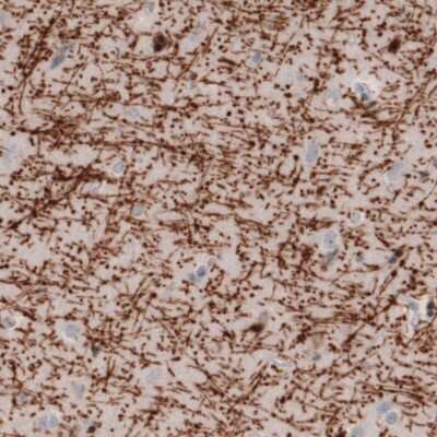 Immunohistochemistry: MBP Antibody (CL2827) [NBP2-46631]
