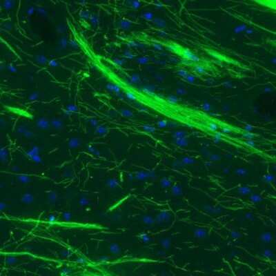 Immunohistochemistry: MBP Antibody (CL2827) [NBP2-46631]