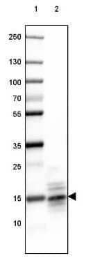 Western Blot: MBP Antibody (CL2827) [NBP2-46631]