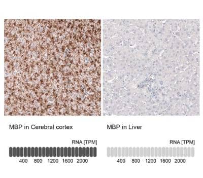 Immunohistochemistry-Paraffin: MBP Antibody (CL2829) [NBP2-46632]