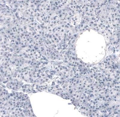 Immunohistochemistry-Paraffin: MBP Antibody (CL2829) [NBP2-46632]
