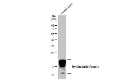 Western Blot: MBP Antibody (HL1033) [NBP3-13687]