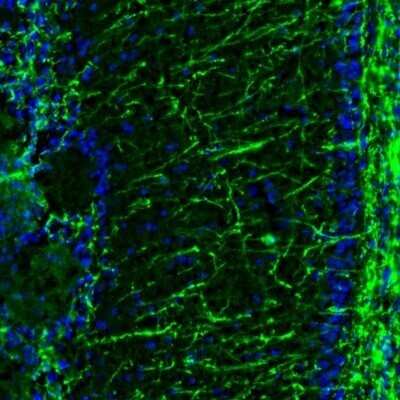 Immunohistochemistry: MBP Antibody [NBP2-33555]