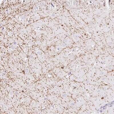 Immunohistochemistry-Paraffin: MBP Antibody [NBP2-33555]