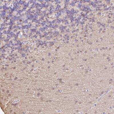 Immunohistochemistry-Paraffin: MBP Antibody [NBP2-33555]