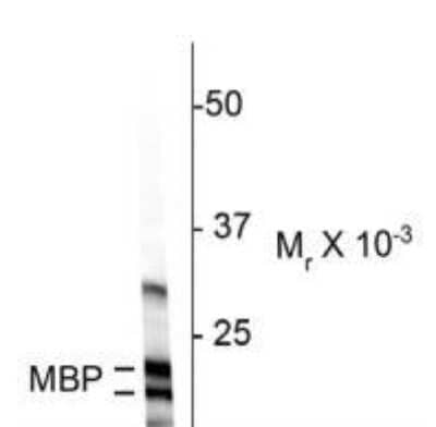 Western Blot: MBP Antibody [NBP2-29656]