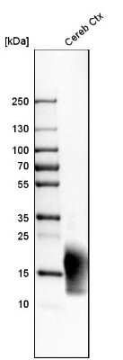 Western Blot: MBP Antibody [NBP2-33555]