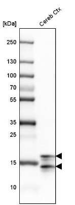 Western Blot: MBP Antibody [NBP2-33555]