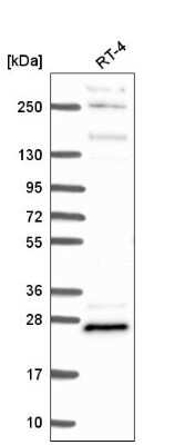 Western Blot: MBP Antibody [NBP2-56185]