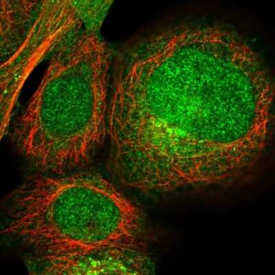 Immunocytochemistry/ Immunofluorescence: MBTD1 Antibody [NBP1-93989]