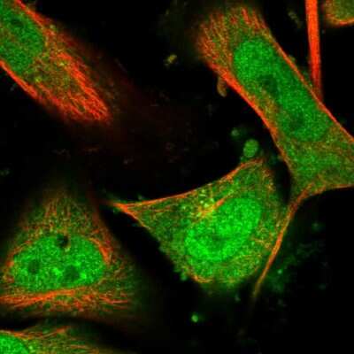 Immunocytochemistry/ Immunofluorescence: MBTD1 Antibody [NBP1-93989]