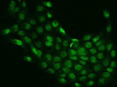 Immunocytochemistry/ Immunofluorescence: MBTD1 Antibody [NBP3-06299]