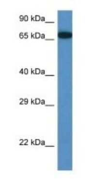 Western Blot: MBTD1 Antibody [NBP1-91375]