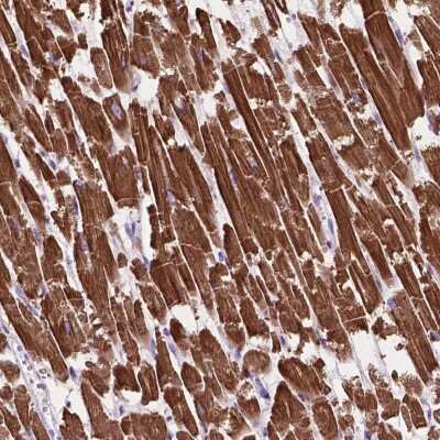 Immunohistochemistry: MBTPS1 Antibody [NBP2-49214]