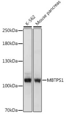 Western Blot: MBTPS1 AntibodyAzide and BSA Free [NBP3-05161]