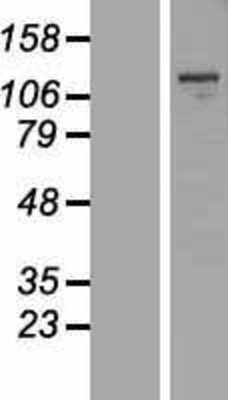 Western Blot: MBTPS1 Overexpression Lysate [NBL1-12936]