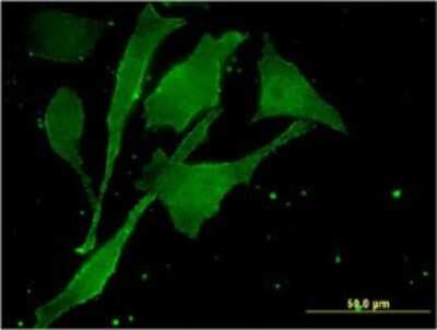 Immunocytochemistry/ Immunofluorescence: MBTPS2 Antibody (1A3) [H00051360-M01]