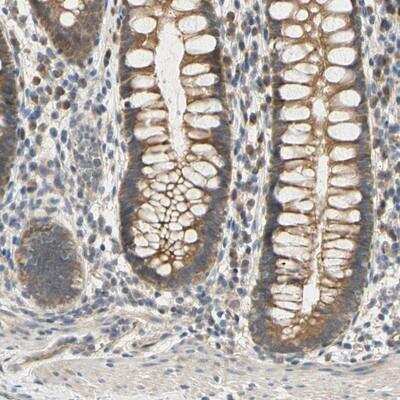 Immunohistochemistry-Paraffin: MBTPS2 Antibody [NBP1-80800]