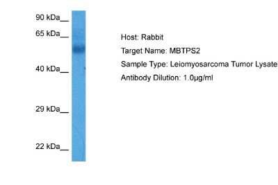 Western Blot: MBTPS2 Antibody [NBP2-85261]