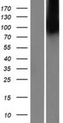 Western Blot: MBTPS2 Overexpression Lysate [NBP2-07118]