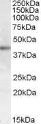 Western Blot: Melanocortin-2 R/MC2R Antibody [NB100-93419]