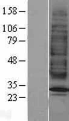 Western Blot: Melanocortin-2 R/MC2R Overexpression Lysate [NBP2-04160]