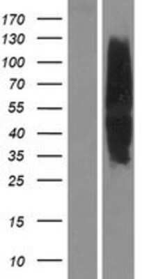 Western Blot: Melanocortin-4 R Overexpression Lysate [NBP2-04303]