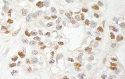 Immunohistochemistry: MCAF1 Antibody [NB100-438]