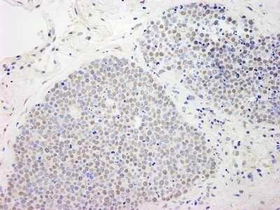 Immunohistochemistry-Paraffin: MCAF1 Antibody [NB100-438]